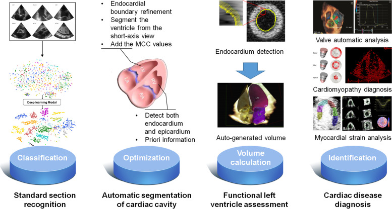 Application of AI in echocardiography.